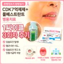 엄마의마음 | 유방암4기 엄마의 풀베스트란트 후기 CDK7억제제 병용치료 1싸이클 3회차 후기