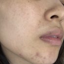 남7통 | 속건조 드디어 벗어남... 싸이언티픽 콜라겐 솔직 후기[7통 비움]