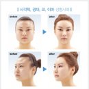 환골탈태