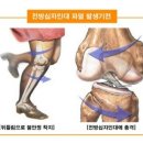 전방