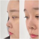 이물감 없고 너무 편안한 평촌 led 속눈썹연장 아냥뷰티 후기 및 추천