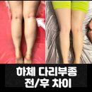 동남산전(주) | 천안피부관리 하체부종부터 순환관리까지｜신부동피부관리 웰니스 관리 기준 정리