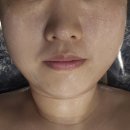 [영등포 에스테틱] 24k 황금으로 승모근, 턱선 만들어러주는 마리앙 에스테틱 윤곽관리 후기