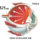 아토피성 결막염, 백내장, 망막박리, 녹내장, 이미지