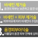 봄비뇨기과의원 네이버블로그