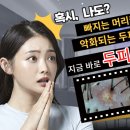 모리온두피탈모 이미지
