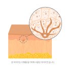 고운빔의원 | 울산 기미치료 왜 여러 번 나눠서 받을까? 기미 관리 전에 꼭 알아야 할 이야기