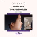 뉴진성형외과 이미지