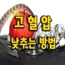 고혈압 낮추는 방법 및 음식 이미지