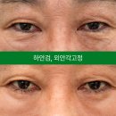 아이케이성형외과의원 네이버블로그