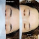 이미지헤어라인 이미지