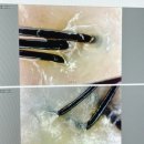산본두피관리 [모앤두피탈모 산본점] SMD 초기탈모관리 솔직후기 / 군포두피, 모앤두피, 헤드스파