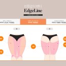 엣지라인의원 | 허벅지지방흡입잘하는곳 라인 선택 중요