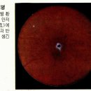 당뇨병학회, 당뇨환자 여름철 발관리 수칙 마련 이미지