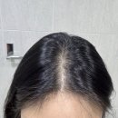 다이아약국 | 약국에도 입점 된 탈모증상 완화 VT 리들샷 헤어앰플 피디알엔 리들샷 헤어앰플 사용 후기!