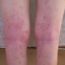 자강한의원 이미지