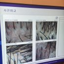 모앤영 당산점 | 영등포헤드스파 모앤영 당산점 두피관리하러 다녀온 후기
