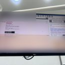 서울센텀구강내과치과의원 턱관절 치료 후기 3탄 (6개월 만에 x-ray 촬영)