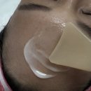 천안두정초등학교 | 천안피부관리 오마주21스킨케어로 갸름한 얼굴을