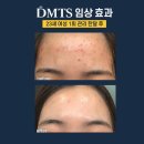 피부,맑음 이미지