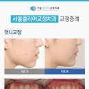 서울클리어치과교정과치과의원 이미지