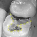 보강치과기공소 이미지