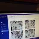 세븐일레븐인천부평삼산점 | 인천탈모 부평탈모 관리 닥터모락 인천삼산점 데톡스 케어