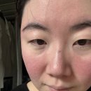 탈리다쿰 "에센스 수" 30일 여정 후기 - 쫜득한 속 보습+붉은기 진정