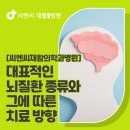 씨엔씨재활의학과병원 | 씨엔씨재활의학과병원 대표적인 뇌질환 종류와 그에 따른 치료 방향