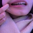 우성약국 | CMC우성구강악안면외과치과 사랑니 발치 후기🦷