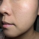 (주)듀얼헬스케어 | 듀얼테트라 vs 큐리케어 펄즈, 양쪽 볼 다르게 써봤어요 (1회 사용 비교) 내돈내산 후기