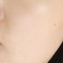 에스투메디칼 이미지