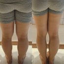 오화체형동안 | 목동 신정동 골반교정 오화체형동안에서 휜다리교정 극찬 후기