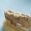 나온치과기공소 이미지