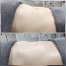 중산3길 | 전주" 이너뷰티 "바디관리샵 전주림프관리 인비덤 맥스 바디 체형관리 받아본 후기