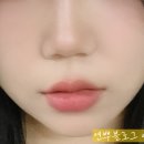 맑을린피부관리