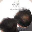 더 채움 스칼프