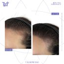 탈모왕 본점 이미지