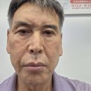 신봉침한의원 Daum카페