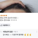 돕스칼프 이미지