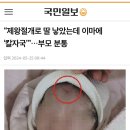 제왕절개 하다가 의사 과실로 아기 얼굴에 칼자국 이미지