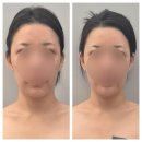 안녕당신 | 천안 비대칭 관리 당신의얼굴형프로젝트 솔직 후기