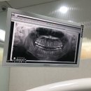 요한치과기공소 이미지