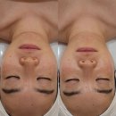 레몬트리 | 남천동 피부관리 레몬트리에스테틱 쿨다운 장벽관리 솔직후기