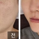 제이엔스킨케어