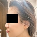 종로위브의원 이미지