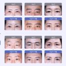 예스성형외과의원 이미지