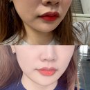이준프라임 | 압구정로데오 울쎄라, 리프팅 궁금하다면 꼭 체크하고 결정하세요