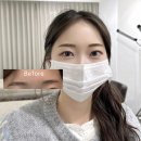 글로우브로우