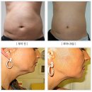 나사랑의원 이미지